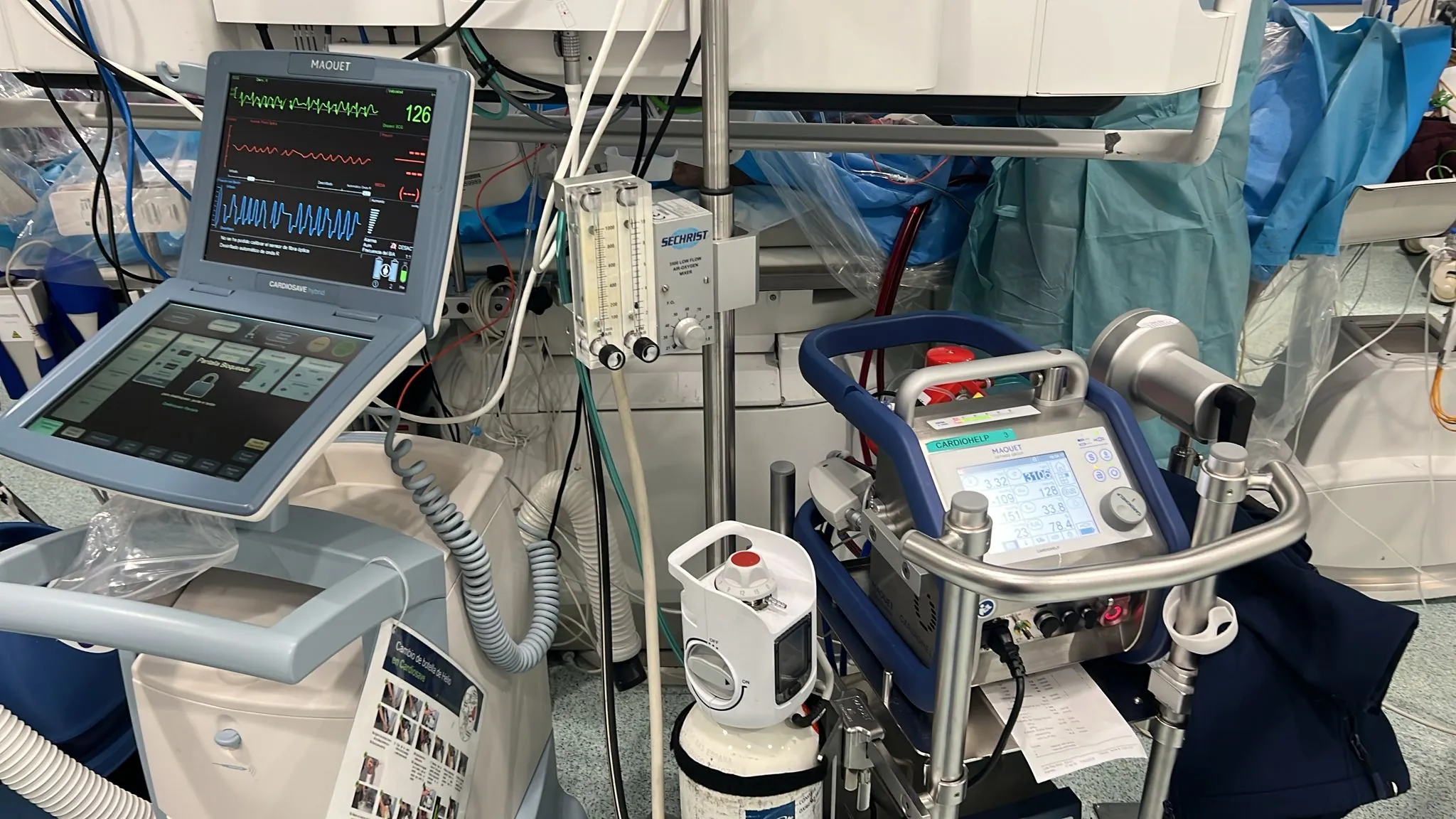 Caso Real de Activación de Código IAM con Obstrucción de la Coronaria Derecha