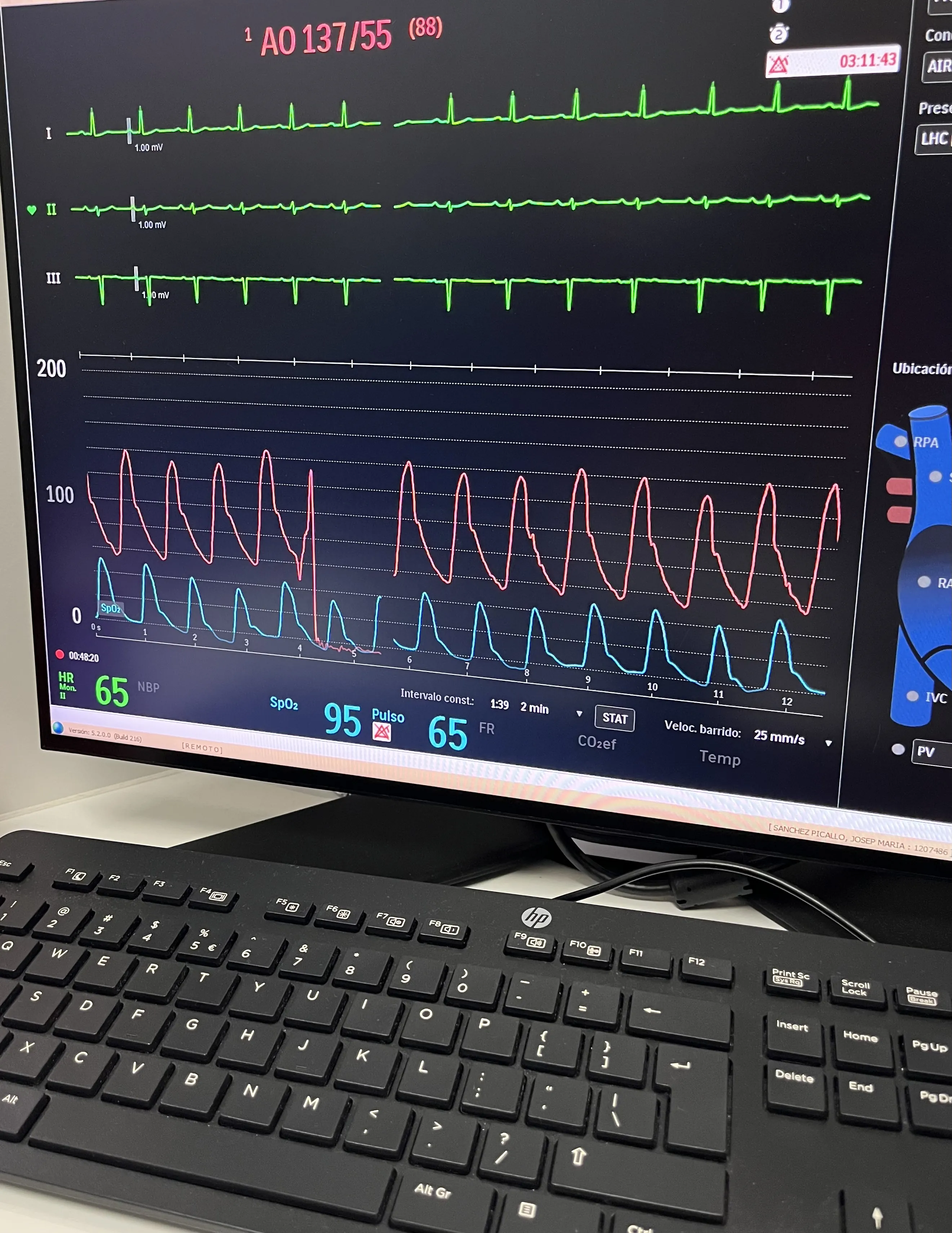 Papel de la enfermera en la sala de Hemodinámica en el Hospital de Sant Pau