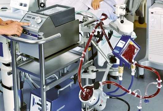Máquina ECMO: soporte vital avanzado en situaciones críticas