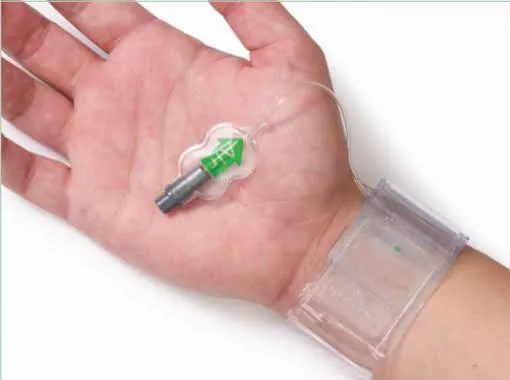 Técnicas de hemostasia y cuidados de enfermería en hemodinámica