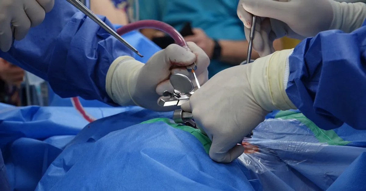 Aneurisma: concepto, riesgos y manejo en hemodinámica